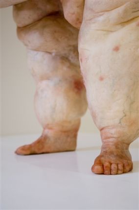 Wellcome Collection
